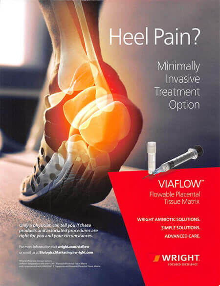 PLANTAR FASCITIS & HEEL PAIN TREATMENT DUBLIN FOOT CLINIC EXCEPTIONAL HEEL  CARE TRUSTED – EFFECTIVE – INNOVATIVE