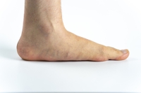 Risk Hazards for Developing Flat Feet