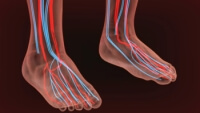 Peripheral Neuropathy