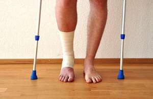 Healing Time Frame for Stress Fractures