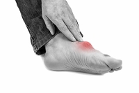 Can Orthotics Help Bunions?