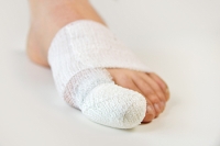How Are Broken Toes Treated?