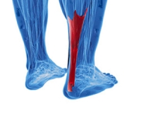 What Can Cause an Achilles Tendon Injury?