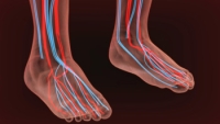 Definition and Causes of Poor Foot Circulation