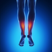 Causes of an Achilles Tendon Rupture