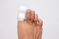 Is It a Broken Toe?