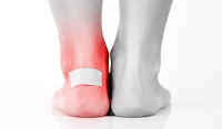 Why Do Blisters on the Feet Develop?