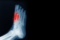 Forefoot Pain