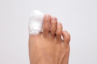 Mild or Severely Broken Toes Are Uncomfortable